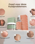Anti acne en onzuiverheden bundel - Velveux - 8720865759081 - Vegan en Natuurlijke skincare routine's